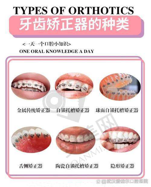 为什么选择洛阳中诺口腔医院进行牙齿矫正？