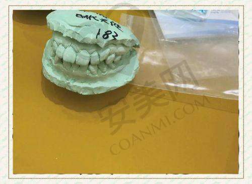 做时代天使隐形矫正，需要注意什么？
