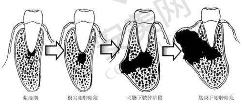 复诊：巩固治疗成效