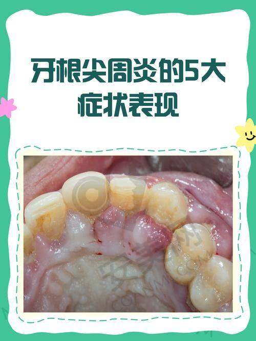 总结：合肥美奥口腔医院治疗牙周炎的体验