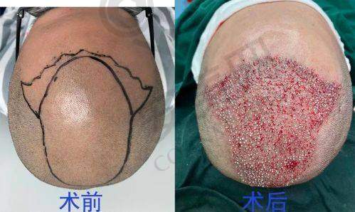 成都丝缘毛发医院的医生团队专精吗？