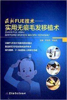 成都丝缘毛发医院与其他毛发医院相比有哪些优势？