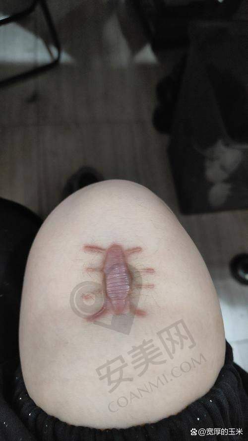 苏州乐桥疤痕研究院如何确保收费的合理性和透明性？
