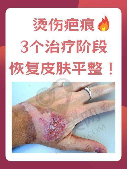 与其他医院相比，苏州乐桥疤痕研究院收费高吗？