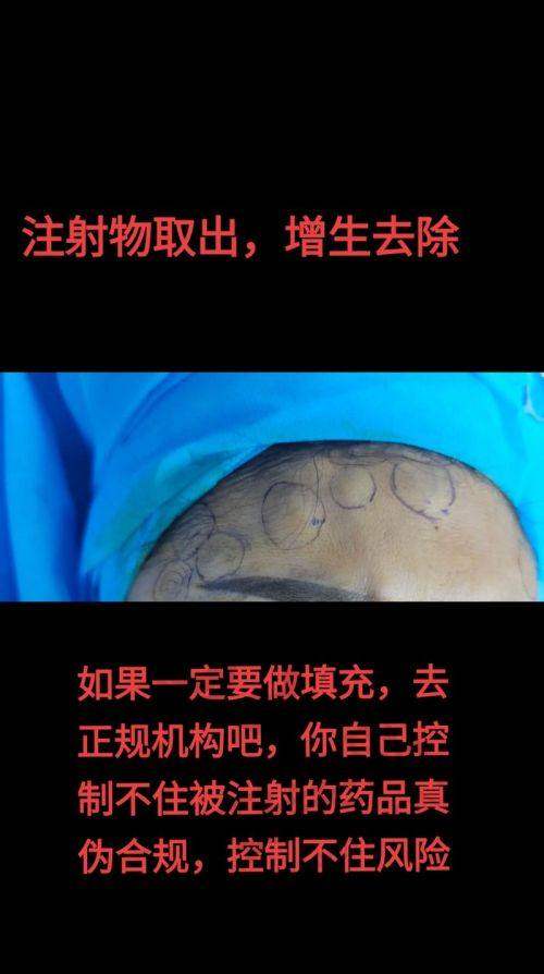 如何选择北京异物取出医院