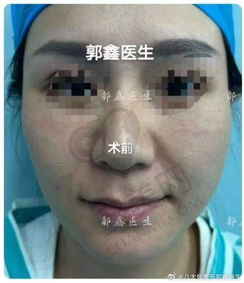 北京知音医疗美容：针孔取物术的佼佼者