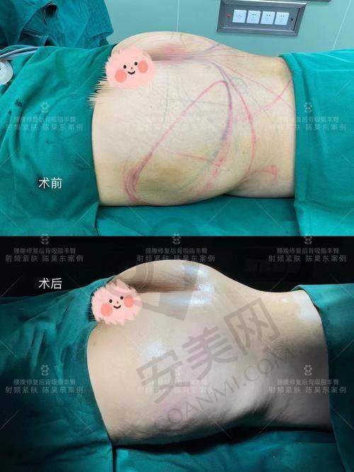 成都莱瑞拉的服务怎么样？全程贴心陪伴