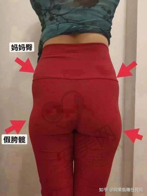 成都莱瑞拉臀部整形有哪些技术特色？手术方案揭秘