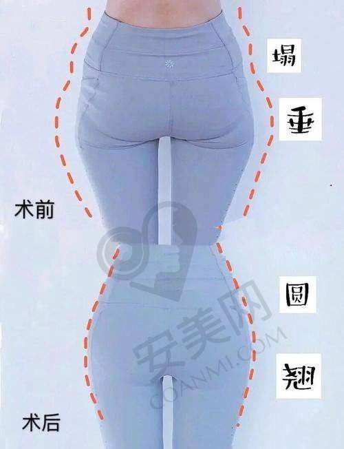 手术过程可怕吗？亲身经历分享