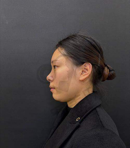 在成都八大处整形医院就诊的服务体验如何？