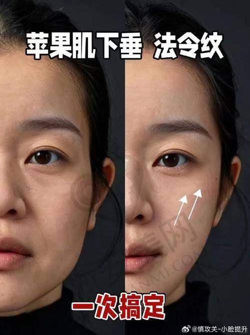 成都八大处整形医院注射玻尿酸技术有什么特色？