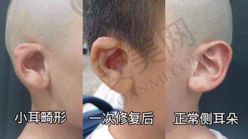 广州壹加壹整形医院有哪些特色项目？