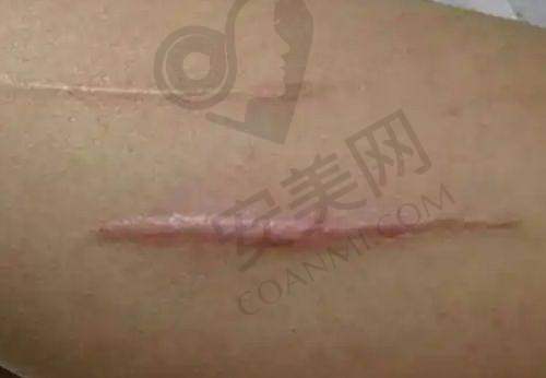 武汉恩吉娜中爱医疗美容医院预约挂号流程：
