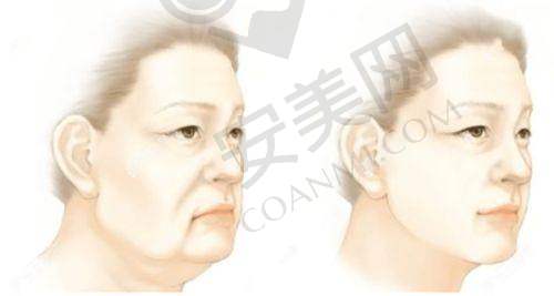 特色项目谁更有吸引力？