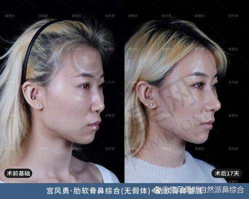 为什么选择广州壹加壹李明院长？
