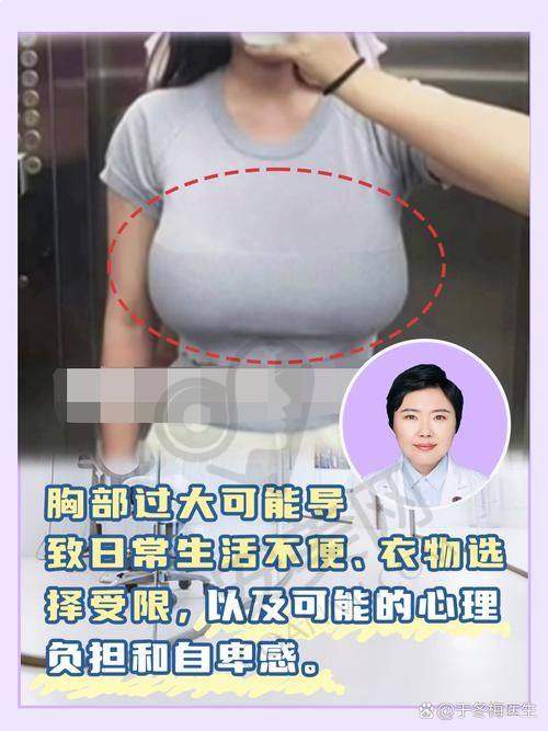 成功实例：见证巨乳缩小的神奇成效