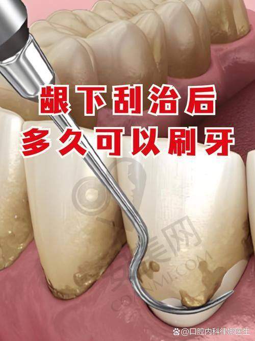 烟台壹颗芽口腔胡庆莹医生牙周刮治的成效如何？