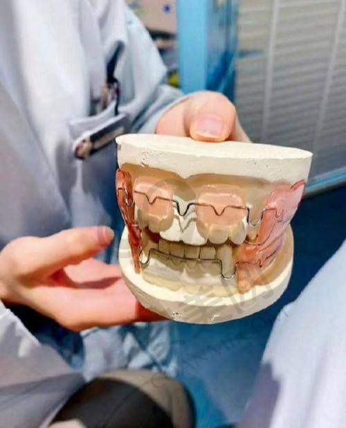 5、重庆中三口腔刘亚新医生患者评价：