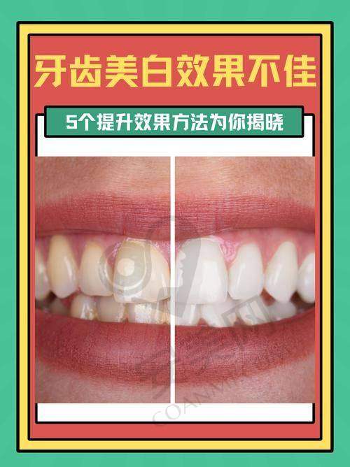 烟台壹颗芽口腔怎么样？