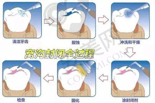 就诊过程是怎样的？