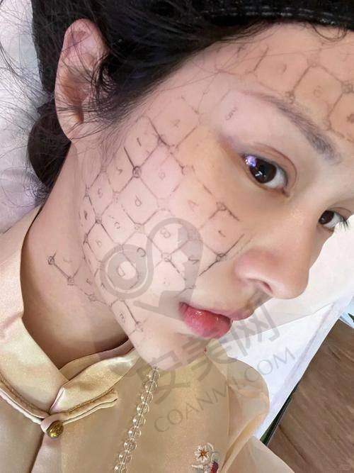 热玛吉四代：抗衰领域的明星项目
