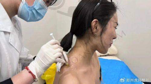 18000元起打造直角肩：价格背后的价值