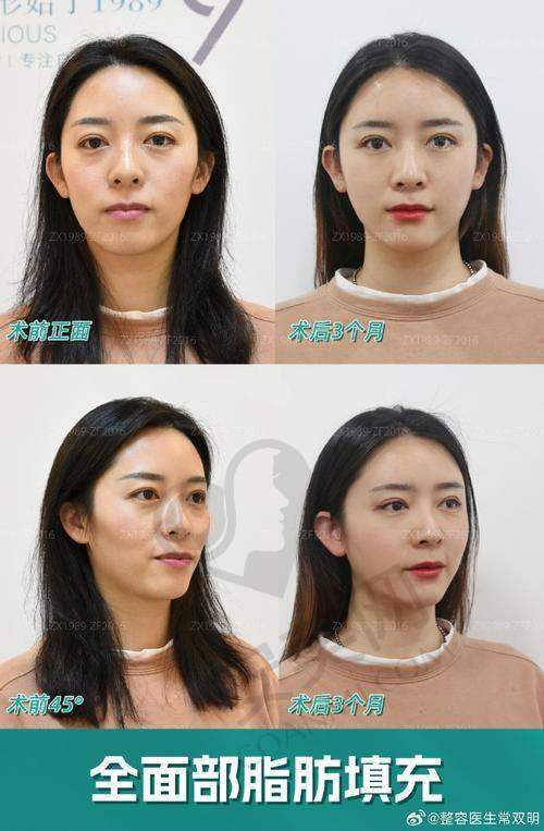就诊过程是怎样的？
