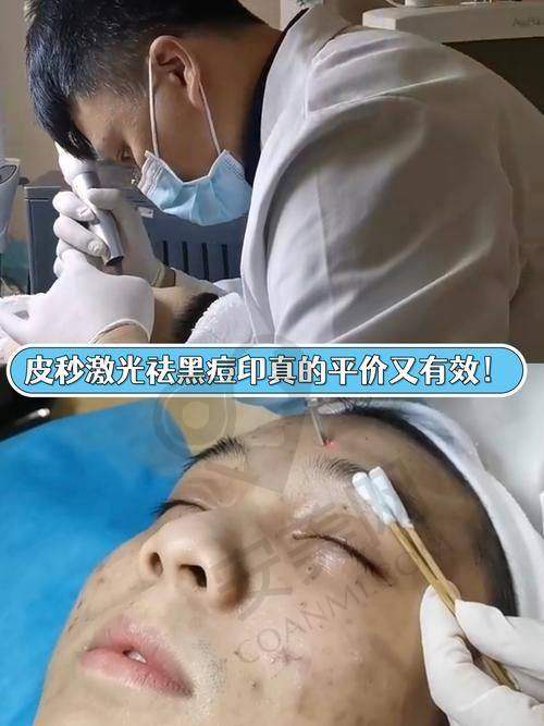 治疗后需要注意什么？