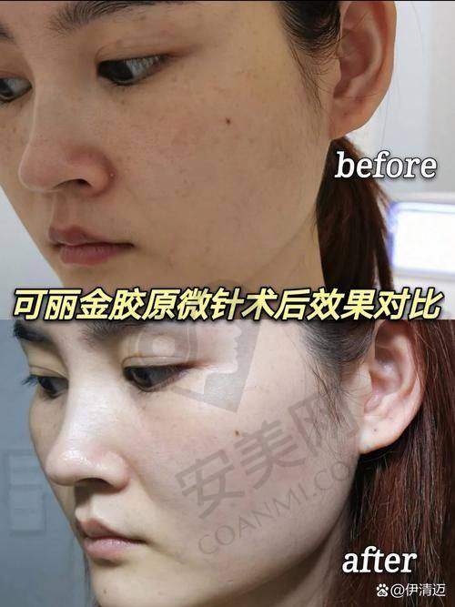 北京艺星美肤抗衰项目有哪些特色？