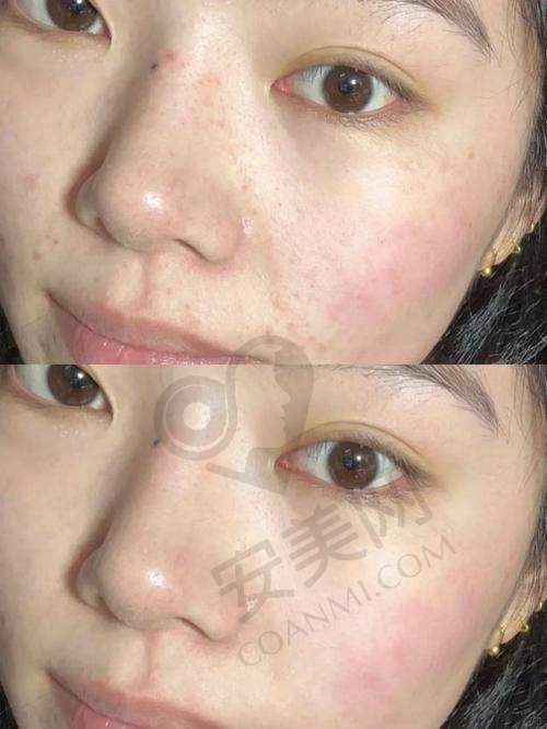 北京艺星美肤抗衰医生专精吗？