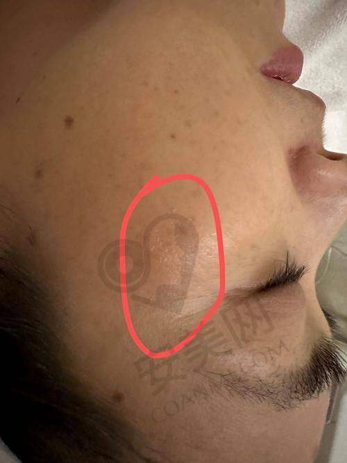 北京艺星美肤抗衰后续服务怎么样？