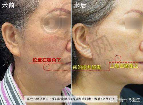 成都素美医院的口碑在行业内处于什么水平？