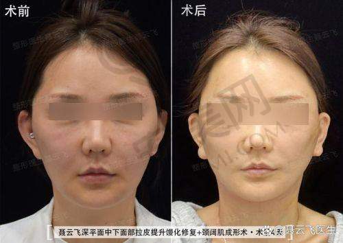 成都素美医院的顾客评价口碑怎样？