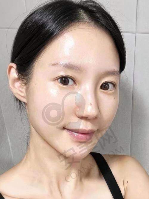 面部提升35000元起：价格背后的奥秘