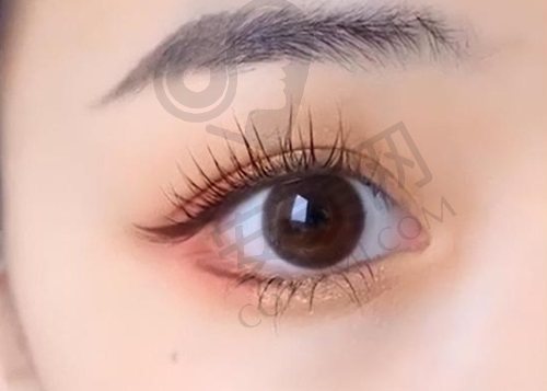 想在绍兴维美做双眼皮？效果、口碑大揭秘，这里做双眼皮真的很不错！ 
