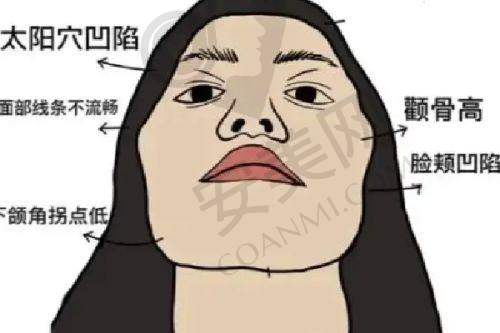 北京轻美颜王子彦医生整形技术怎么样？