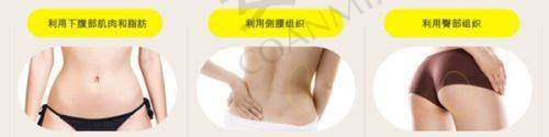 长春悦美汇整形的服务质量如何？