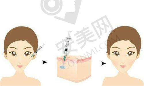 4C不开刀去眼袋术后需要注意什么？