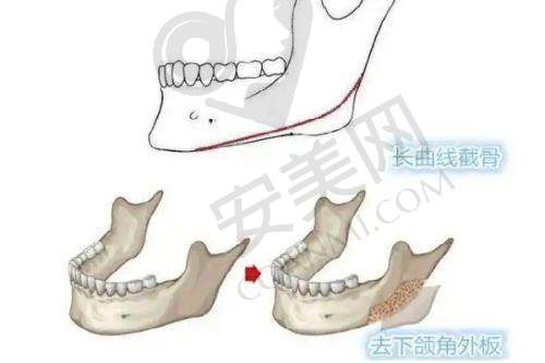 北京轻美颜医疗美容的价格合理吗？