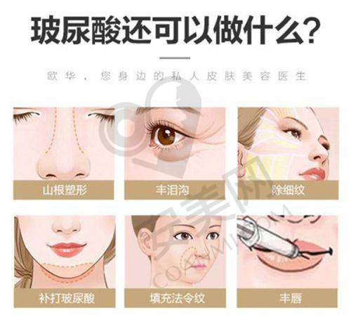 1、绍兴维美罗成医生怎么样？