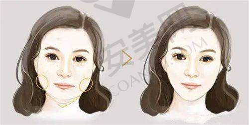 长春悦美汇整形的技术设备精良吗？