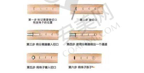 长春悦美汇整形的价格合理吗？