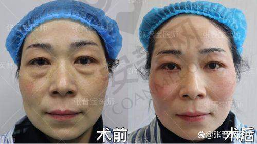 术后护理：保护成效的关键环节