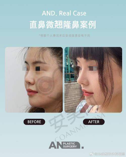 2、深圳艺星文丰医生擅长项目