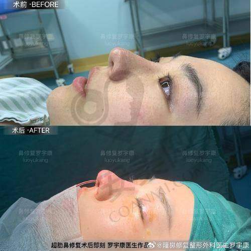 6、深圳艺星文丰医生预约挂号指南
