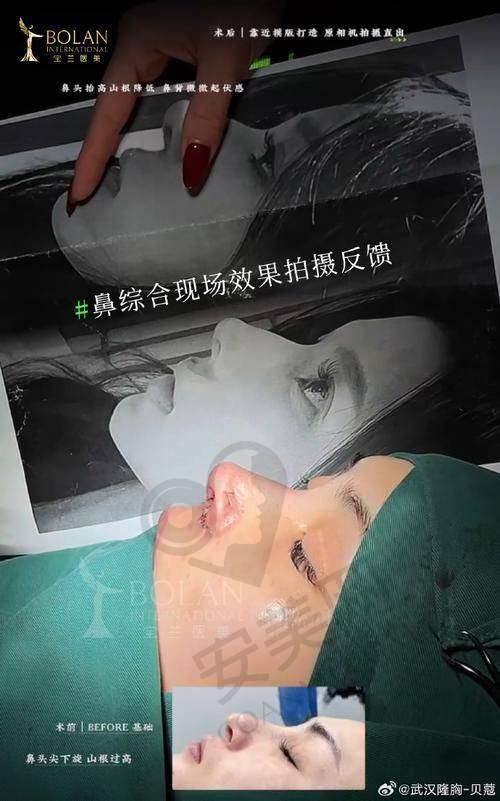 3、深圳艺星文丰医生整形技术怎么样？
