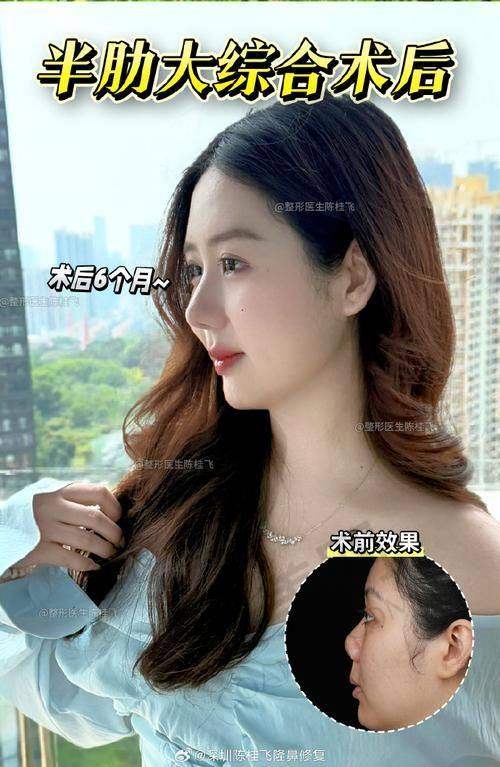 更终的诊疗成效如何？