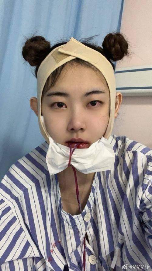 何锦泉医生——正颌手术界的璀璨之星