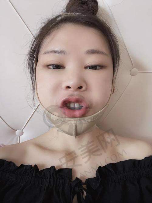 广州广大医院的双颚整形医生团队怎么样？