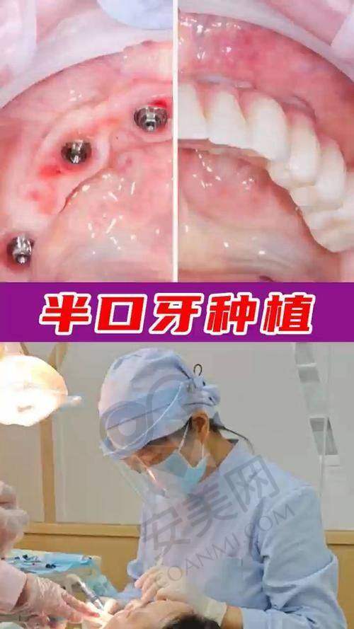 在珠海诺贝尔口腔医院就诊的总体感受如何？